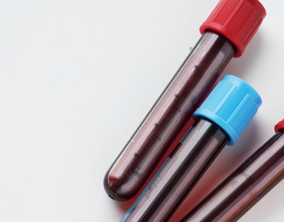 indenizacao-por-falso-diagnóstico-de-HIV